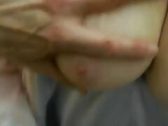 Un médico pervertido procedimiento de boca a boca